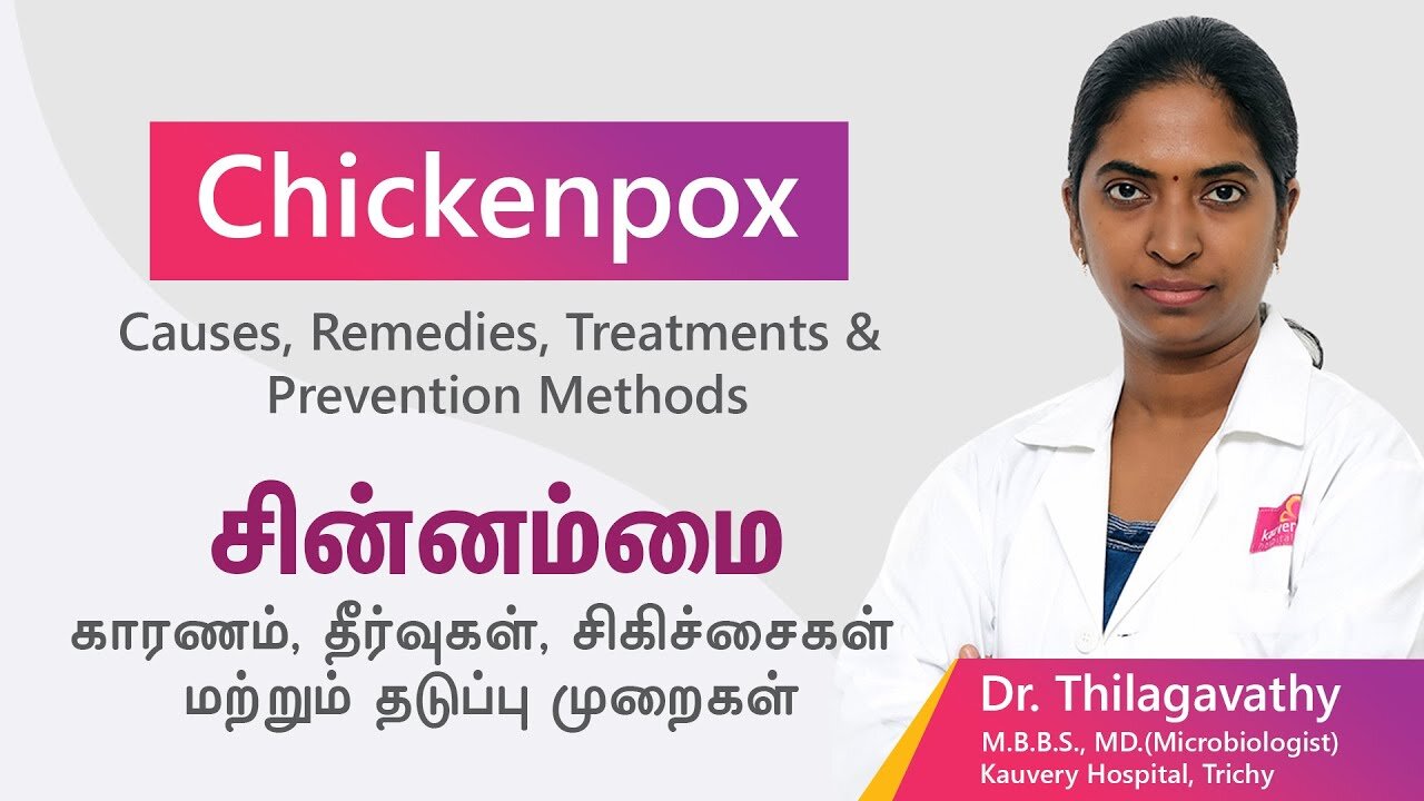 Chicken Pox - Symptoms, Causes, Prevention, Treatment & Awareness