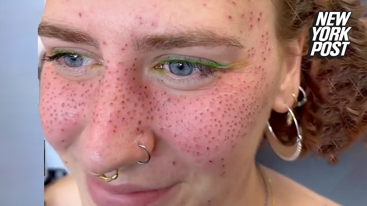 I got freckle tattoos — people say they will 'age like a tramp stamp'