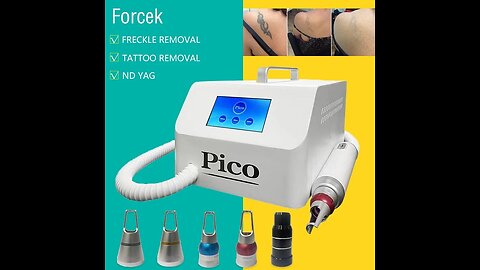 laser tattoo removal machine