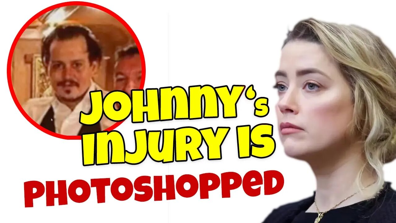 Amber Heard on Cross | Johnny's injury is photoshopped. Mine are real!