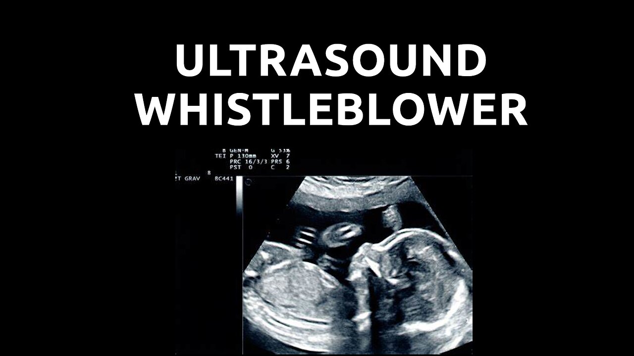 Utrasound Whistleblower