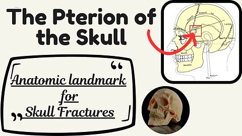 Pterion of the Skull: Anatomy, Importance, and Clinical Significance