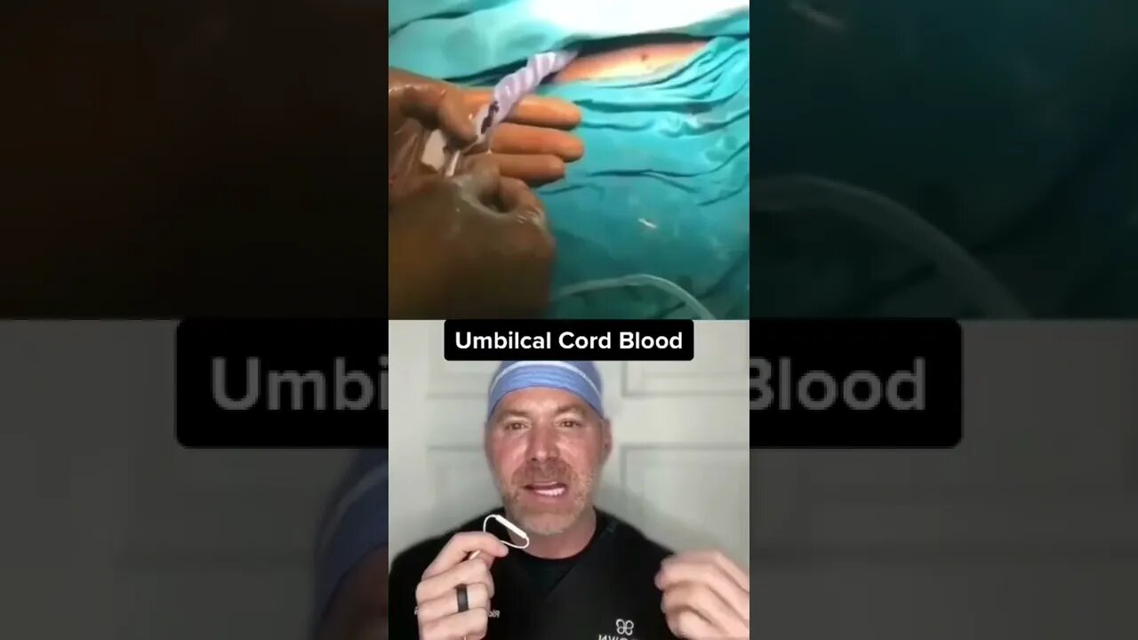 Save Some Umbilical Cord Blood 🩸 #shorts