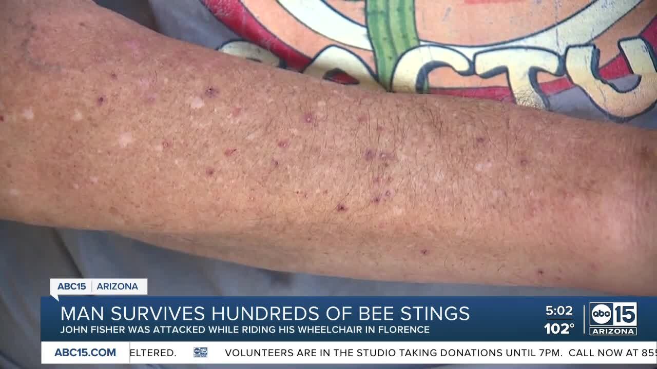 Man stung more than 250 times by bees in Florence, dog stung more than 50 times