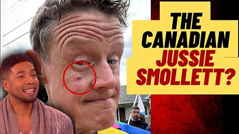 WOKE CANADIAN POLITICIAN FAKES BEING PUNCHED AT PROTEST