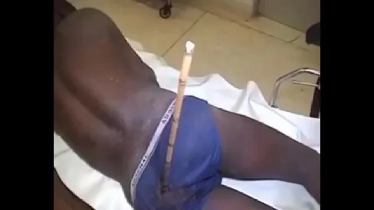 Arsenal fun shot by an arrow in the Butt after the Man United game #shorts