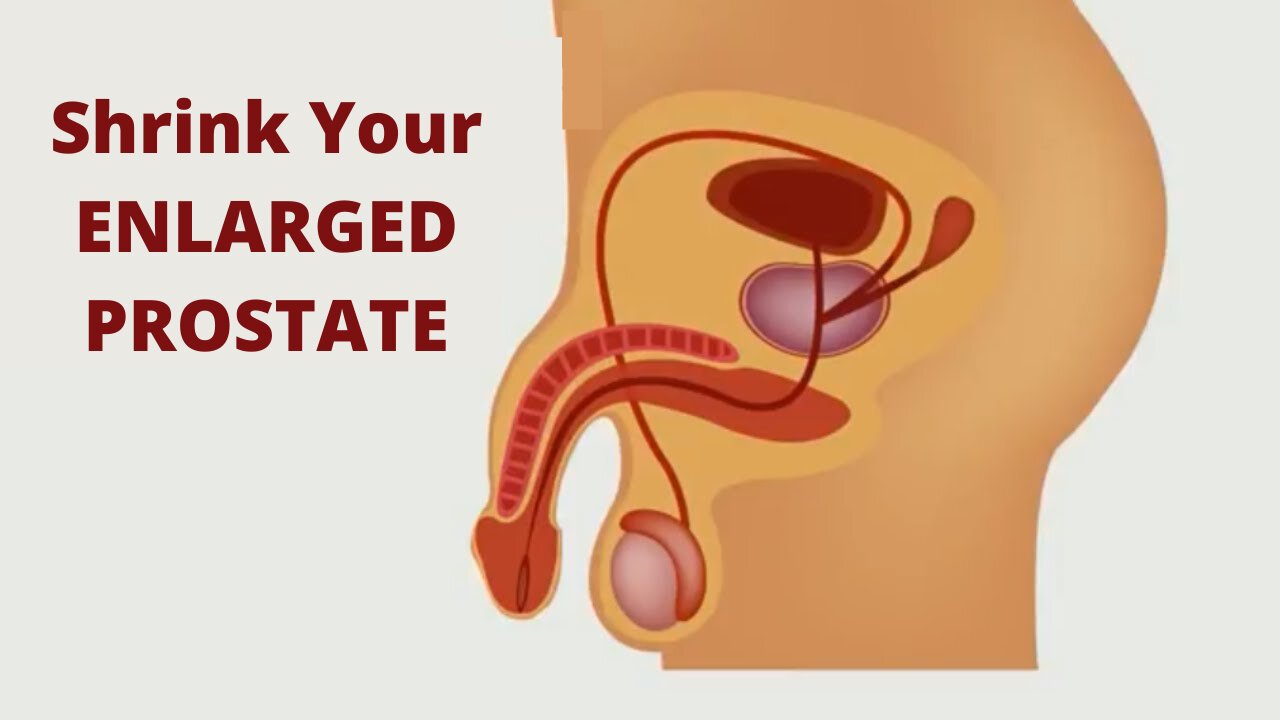 Shrink The ENLARGED PROSTATE at Home