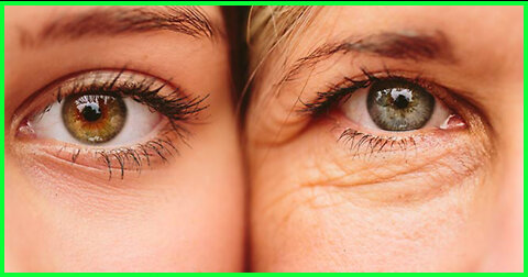 How can I get rid of anti-aging naturally