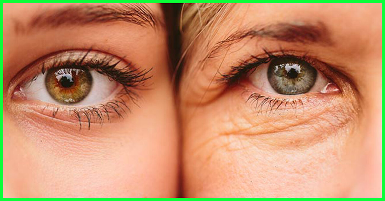 How can I get rid of anti-aging naturally