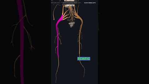 What is sciatica pain ?