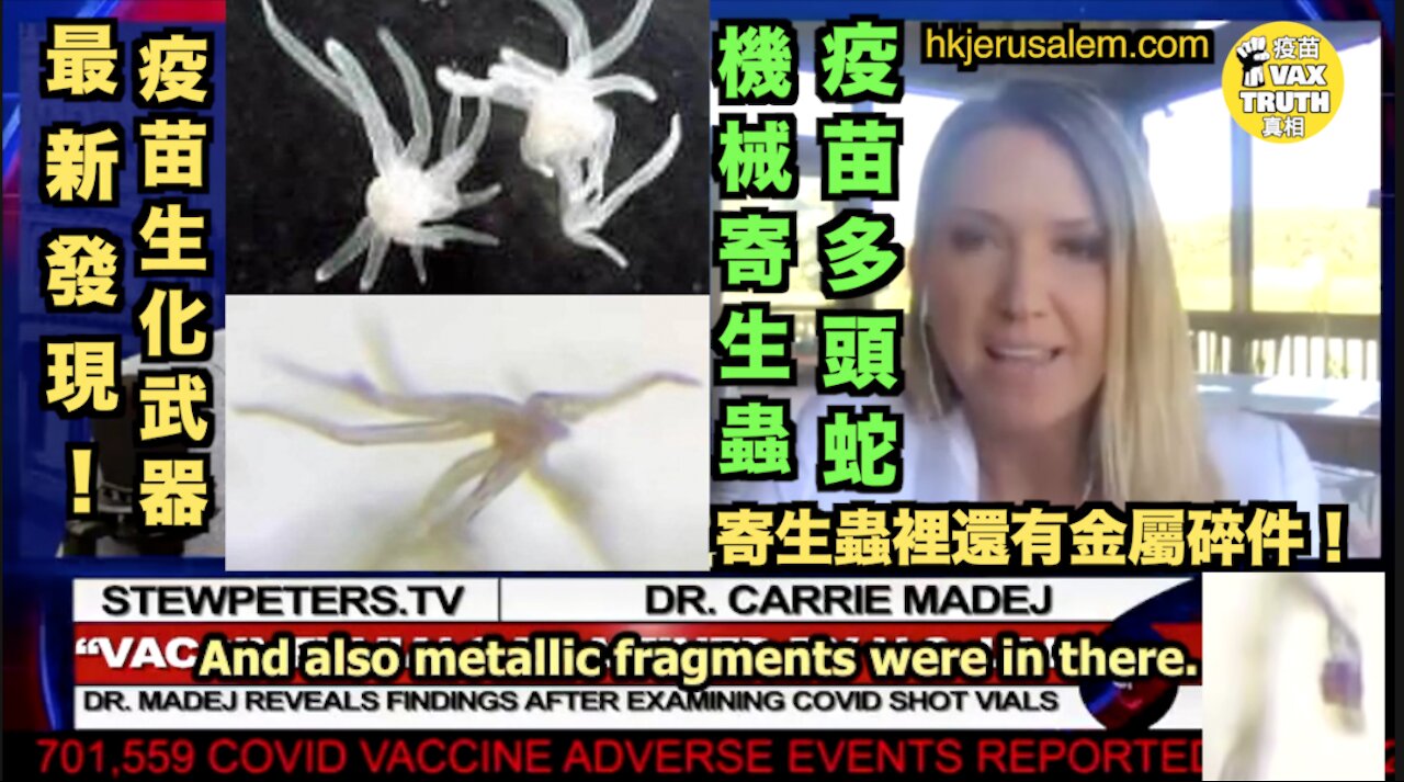 Dr Carrie Madej 逆苗樣本中發現驚人的納米機器寄生蟲，Transhuman 超人類的實驗性產物 Disgusting nano-machine parasites in the v@666ine samples.