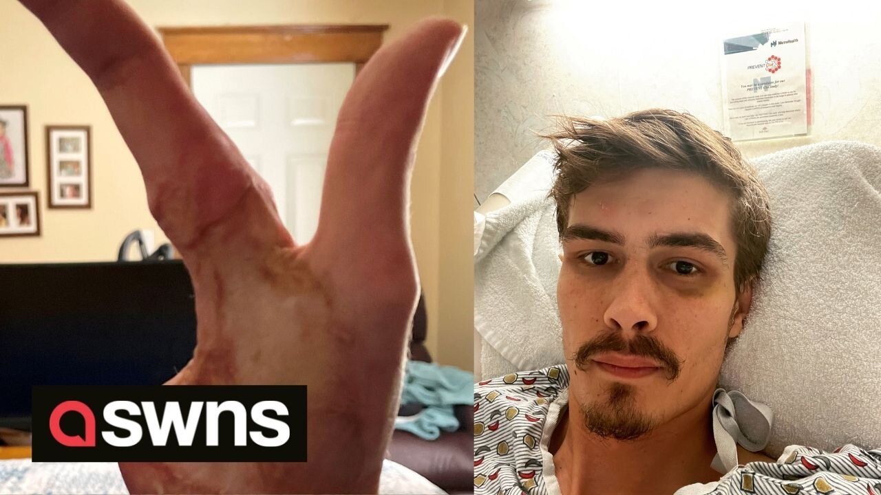 US man shows he can still DRIVE and PLAY GOLF after losing three fingers and leg in train accident