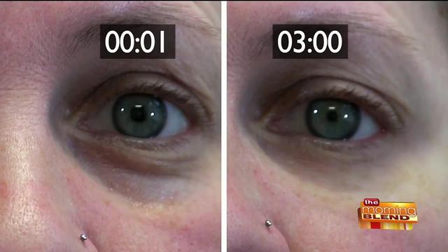 Getting Rid of Under Eye Bags in Minutes!