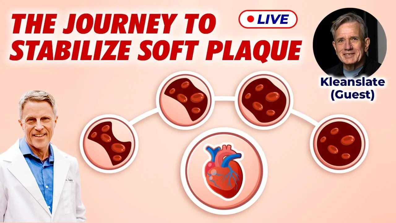 The Journey to Stabilize Soft Plaque (LIVE)