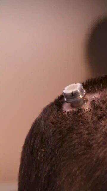 This Implant Turns Brain Waves Into Words! (Extraterrestrials Are Still Giving to Humanity)