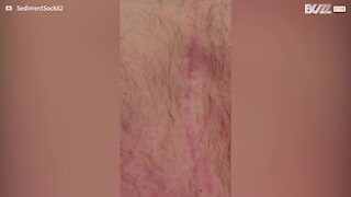 Man's heartbeat is visible to the naked eye