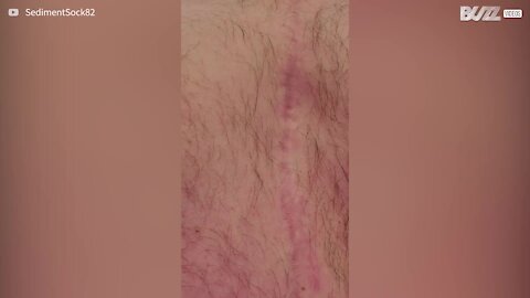 Man's heartbeat is visible to the naked eye
