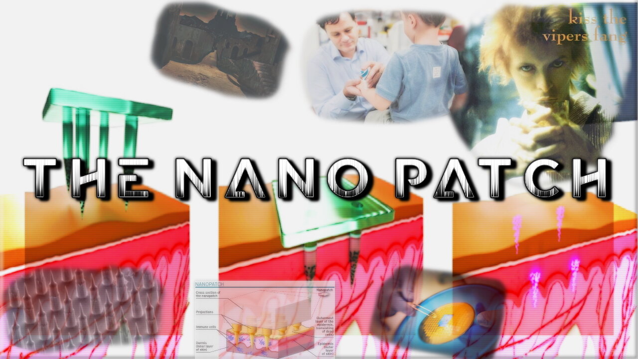 The Nano Patch (Part 2)