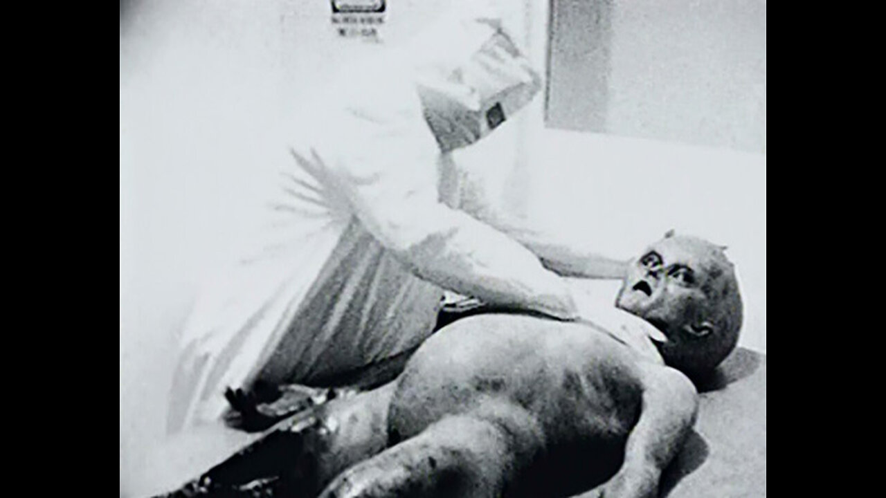 Alien Autopsy Hoax