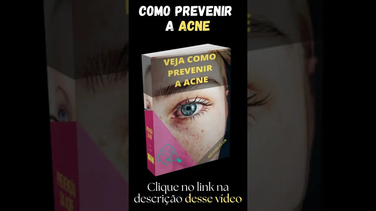 Como prevenir a Acne #shorts