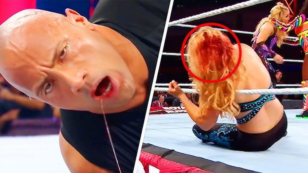 10 Visibly SHOCKING Wrestling Injuries