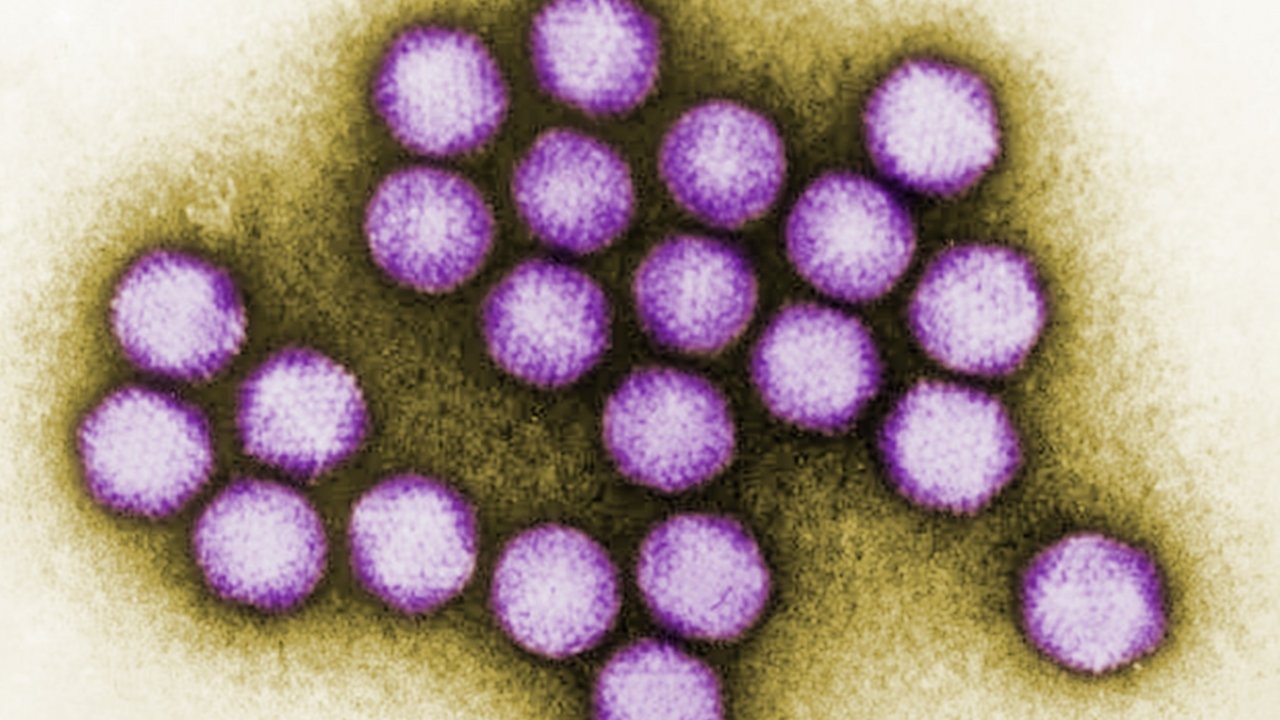 What Makes The Flu-Like Adenovirus So Dangerous?