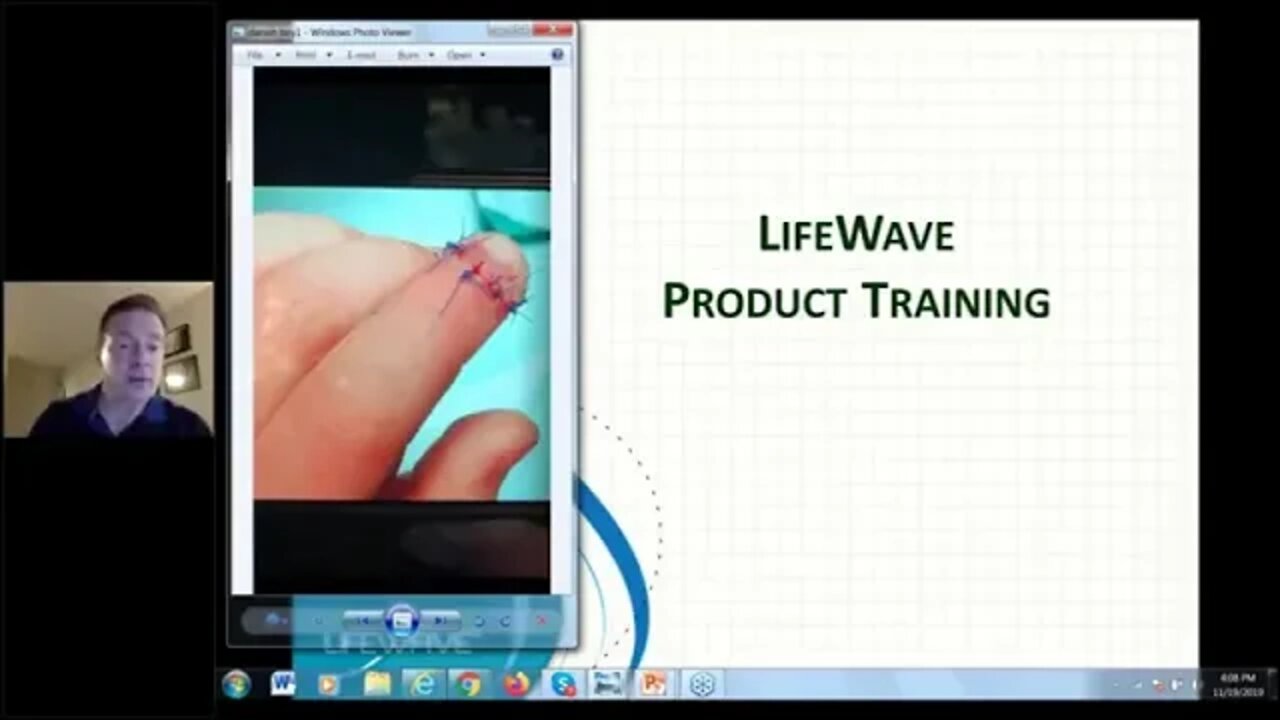 Wound Healing By ACTIVATING STEMCELLS With Lifewave X39 Patches