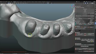 Using ditched margins from the modeldesigner to make crowns