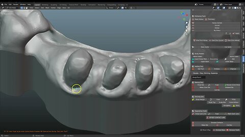 Using ditched margins from the modeldesigner to make crowns