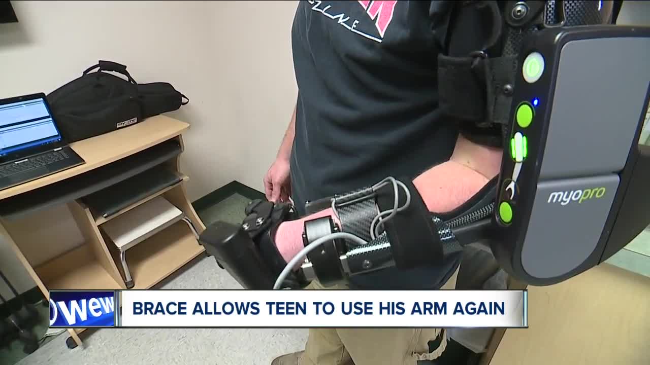 Geauga County company helps people who can't use their arm