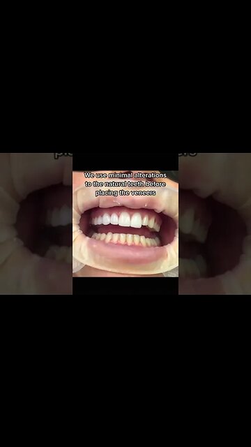 Dental And Teeth Hygiene