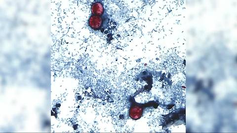 CDC working to determine what is causing illness tied to produce