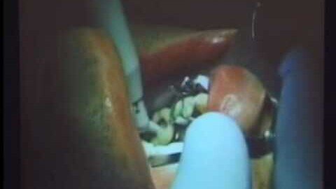 Pt 2 Matt Young DDS discusses time economics in a biological dental practice IAOMT 2007 Tucson