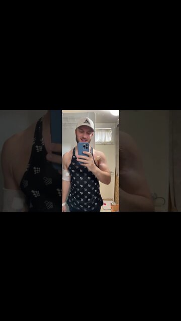 Allergic Reactions to Wound Dressings?