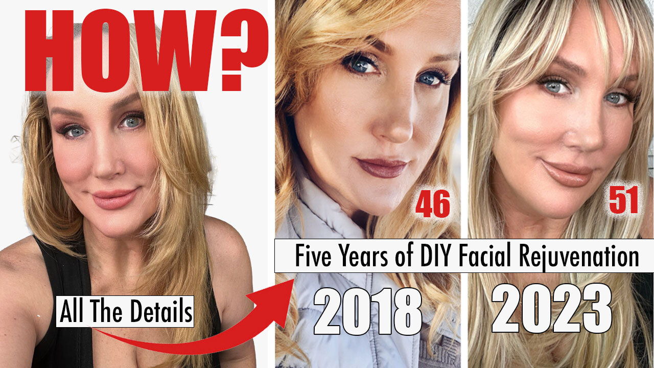 Five Years of DIY Facial Rejuvenation // All the details!