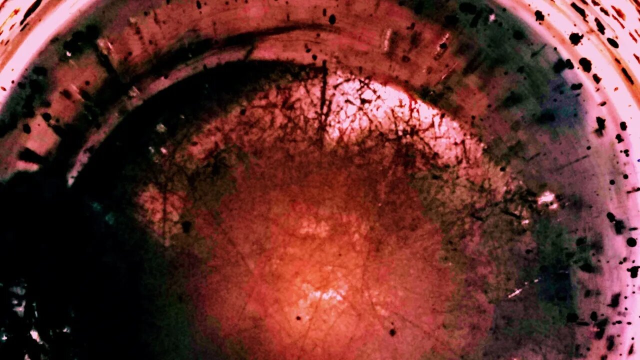 GADOLINIUM DETOX ( MRI CONTRAST AGENT ) | SCALAR ENERGY FIELD ( TESLA COIL )