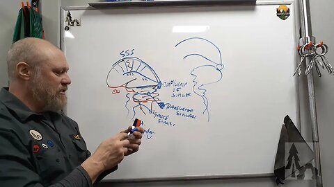 CNS Vasculature #2- Meninges and Venous Drainage