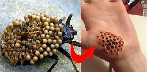 10 most dangerous bugs in the world