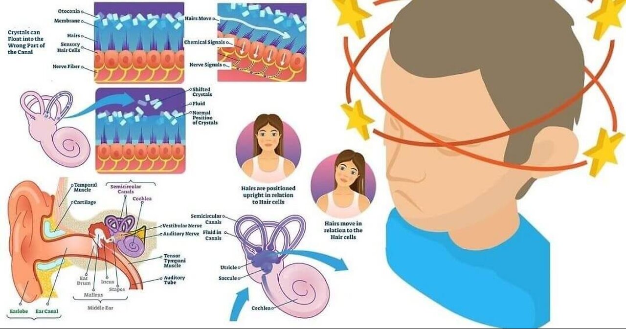 What is VERTIGO? What does VERTIGO mean? VERTIGO meaning, definition & explanation