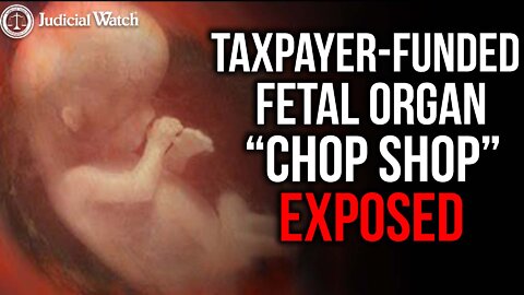 Taxpayer-Funded Fetal Organ “Chop Shop” Exposed!