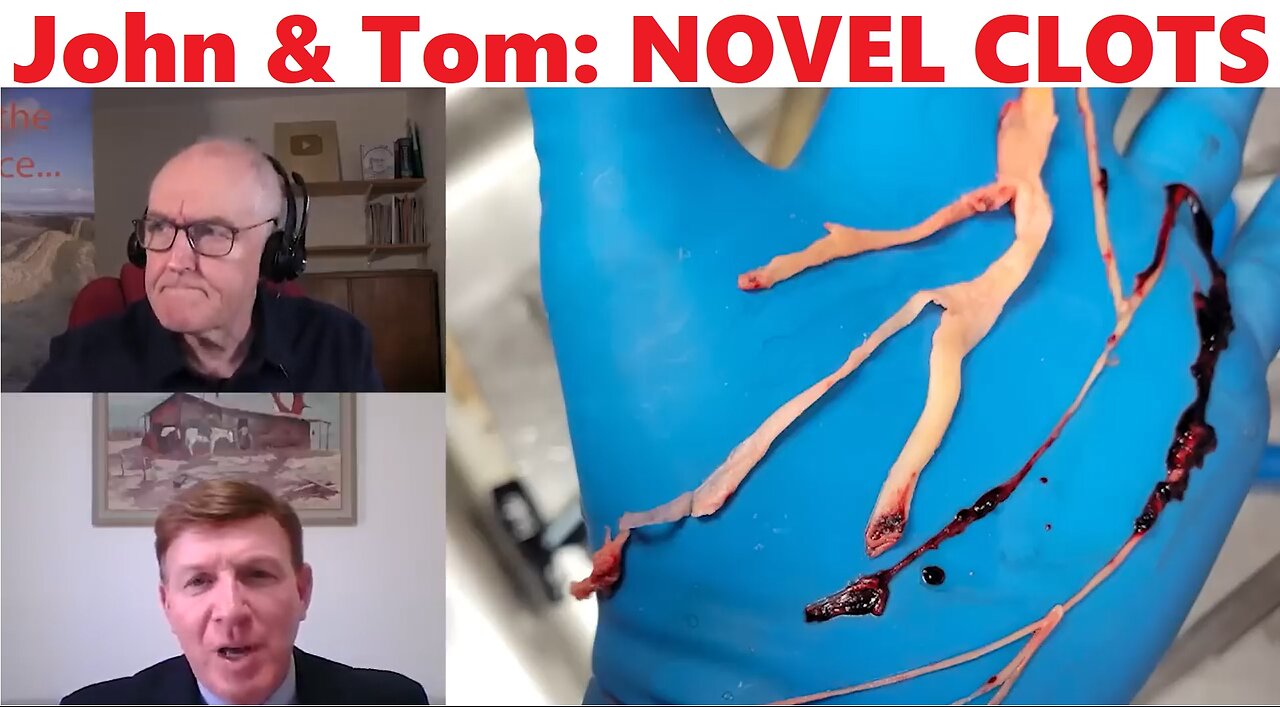 John & Tom: NOVEL CLOTS