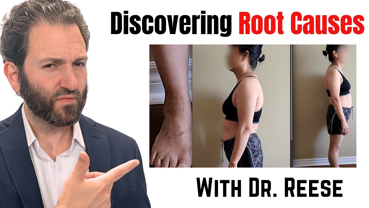 Dr. Reese Finds Sway Back and Bunions on a Woman