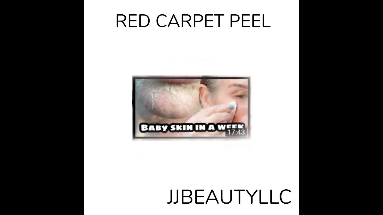 RED CARPET PEEL