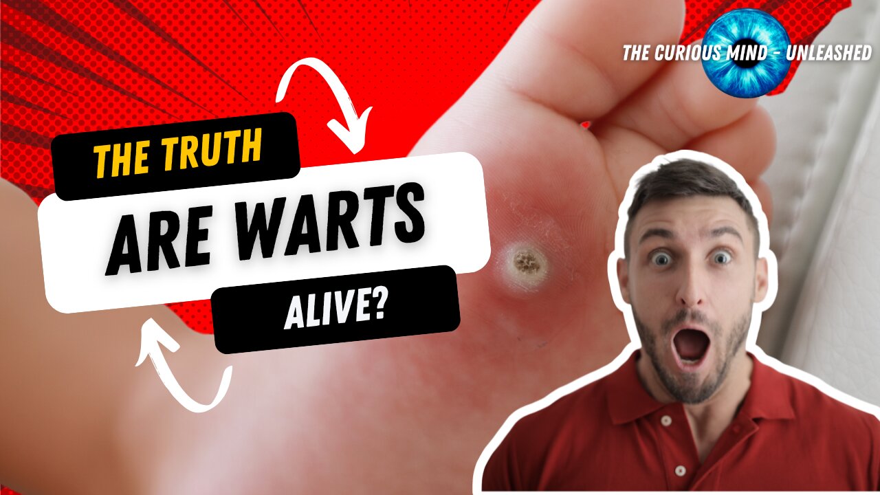 Are Verrucas and Warts ALIVE? Exploring the Secrets of Your Skin's Tiny Invaders!