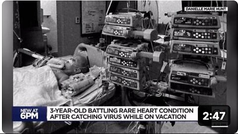 3-Year-Old Toddler Struck by Myocarditis...