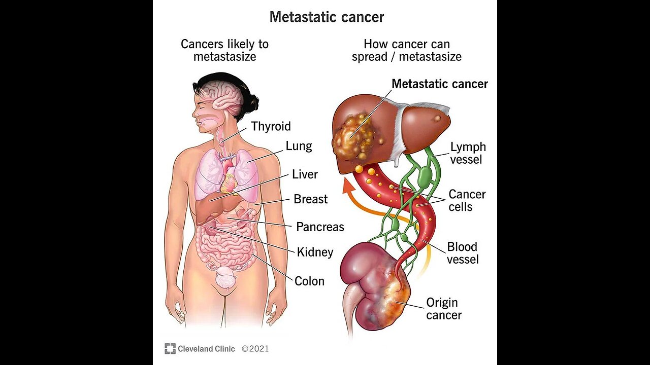 FENBENDAZOLE ANTI CANCER TREATMENT WORKS!