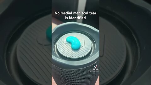 Medial meniscus be like….#medicine