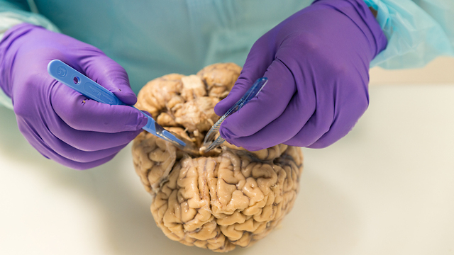 This Man Is Slicing Up Brains For Parkinson’s Research