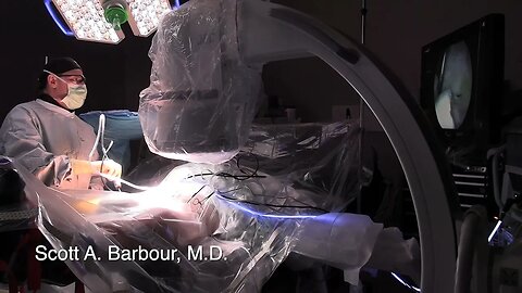 Hip Surgery - Scott A. Barbour, M.D.