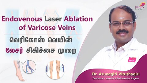 Endovenous Laser Ablation of Varicose Veins